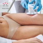 Cure 5 séances (1h) lipocavitation/radiofréquence + lipolaser - FLAWLES FACTORY